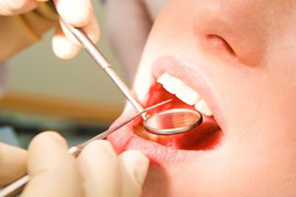 分光测色仪在口腔领域的应用